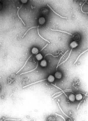 Gamma phage.gif