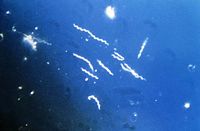 Borrelia burgdorferi.jpg