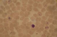 280pk-Plasmodium falciparum 02.jpg